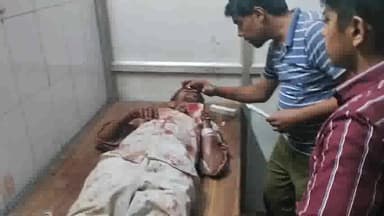 भदोही: कालीन कंपनी से नौकरी कर घर जा रहे व्यक्ति को मर्याद पट्टी में कुत्तों ने बुरी तरह काटा, एमबीएस भदोही में कराया गया भर्ती