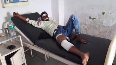 रामपुर: ग्राम धमोरा में मोटरसाइकिल अनियंत्रित होकर डिवाइडर से टकराई, हादसे में पति-पत्नी और बच्चा हुआ घायल