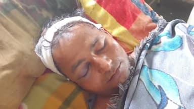 रामपुर: ग्राम बिजपुरी मथुरापुर में 28 वर्षीय व्यक्ति छत से गिरकर हुआ घायल, जिला अस्पताल में कराया गया भर्ती