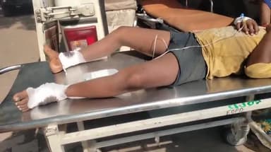 सीतापुर: पंचपुर ग्राम पंचायत के पास साइकिल और मोटरसाइकिल की भिड़ंत में मासूम बच्चा घायल