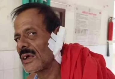 धनबाद/केंदुआडीह: चिरागोडा श्मशान रोड पर घर खाली करने को कहने पर किराएदार ने मकान मालिका का काटा कान, कराई गई पट्टी