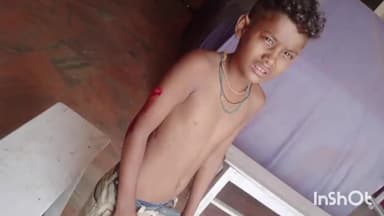 मड़िहान: राजगढ़ के ढडीया पूर्व माध्यमिक विद्यालय में बंदर ने छात्र पर किया हमला, छात्र हुआ घायल