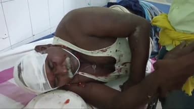 हिलसा: पुना गांव में जमीन विवाद को लेकर हुई मारपीट में पति-पत्नी हुए घायल, बाइक भी हुई क्षतिग्रस्त