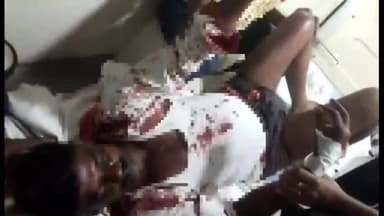 हिलसा: कुर्मीया विगहा गांव के समीप पूर्व पैक्स अध्यक्ष सह स्वास्थ्य कर्मी को अपराधियों ने मारी गोली, पटना रेफर