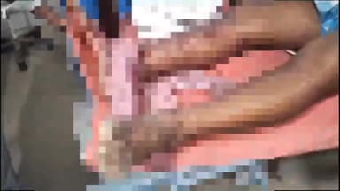 अररिया: शहर के एडीबी चौक के पास अनंत्रित बाइक  की ठोकर लगने से एक व्यक्ति घायल सदर अस्पताल में भर्ती