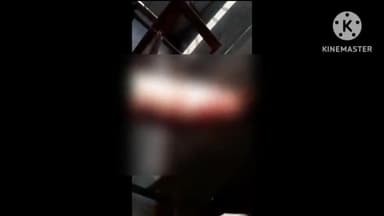 नगर पंचायत भटगांव में आज दूसरे दिन भी जारी है आवारा कुत्तों का आतंक, 5 लोगों को काटकर किया घायल