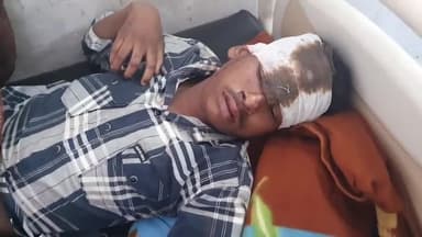 रामपुर: ग्राम बगड़खा में अनियंत्रित होकर गिरने से बाइक सवार 4 किशोर हुए घायल, ज़िला अस्पताल में भर्ती