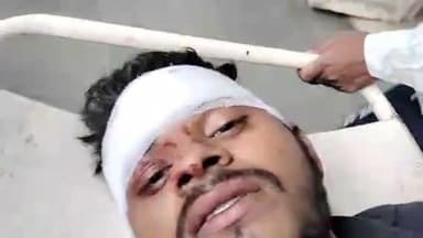 मुरादाबाद: देहात थाना क्षेत्र में तेज रफ्तार ट्रैक्टर-ट्रॉली की टक्कर से बाइक सवार गिरकर हुआ घायल, अस्पताल में करवाया गया भर्ती