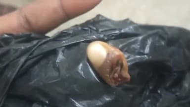 इकौना: मककन पुरवा मे खेलते समय राधा देवी का चारा मशीन में कटा हाथ का अंगूठा