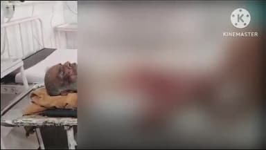 अलवर: हमलाका गांव में खेत में काम करते समय बाजरे की कुट्टी काटने वाली मशीन में फंसा हाथ, कटा