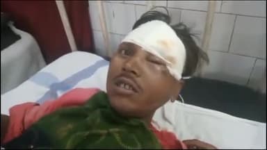 देवेंद्रनगर: पुरुषोत्तमपुर मे सड़क हादसे में गंभीर रूप से घायल हुए 26 वर्षीय युवक जिला चिकित्सालय पन्ना में कराया भर्ती।