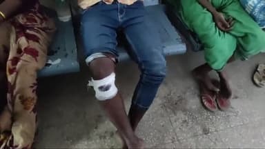 अररिया: महिसाकोल पुल के समीप दो बाइक की हुई भिरंत में बाइक सवार एक युवक घायल सदर अस्पताल में भर्ती