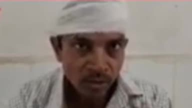 जलालगढ़: कस्बा थाना क्षेत्र के मुरादाबाद में जमीन विवाद लेकर दो भाइयों में मारपीट।मामला कस्बा थाना में दर्ज।