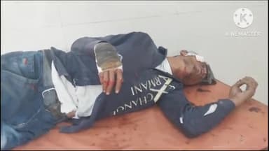 फिरोज़ाबाद: थाना शिकोहाबाद क्षेत्र सहजलपुर के पास डिवाइडर से टकराया ऑटो, सवार युवक गम्भीर घायल