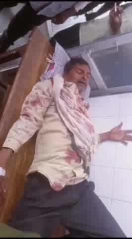 भदोही: स्टेशन रोड पर टोटो से पास लेने के चक्कर में दो टोटो चालकों में हुई मारपीट, एक घायल को अस्पताल में कराया गया भर्ती