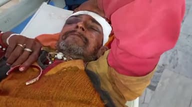 मुरादाबाद: कांठ थाना क्षेत्र में सड़क किनारे खड़े व्यक्ति को तेज रफ्तार अज्ञात वाहन ने मारी टक्कर, जिला अस्पताल में कराया गया भर्ती