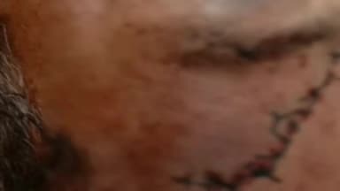 सिहोरा: ग्राम कछपुरा में परिवार पर हुआ प्राण घातक हमला, गोसलपुर पुलिस ने किया मामला दर्ज