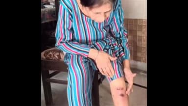 ਐਸਏਐਸ ਨਗਰ ਮੁਹਾਲੀ: ਫੇਸ 1 ਦੇ ਵਸਨੀਕ ਆਵਾਰਾ ਕੁੱਤਿਆਂ ਦੇ ਆਤੰਕ ਕਾਰਨ ਪਰੇਸ਼ਾਨ, ਇੱਕ ਮਹਿਲਾ ਨੂੰ ਮੁੜ ਕੁੱਤੇ ਨੇ ਵੱਢਿਆ, ਕਈ ਵੱਢਣ ਦੇ ਮਾਮਲੇ ਆ ਚੁੱਕੇ ਹਨ ਸਾਹਮਣੇ