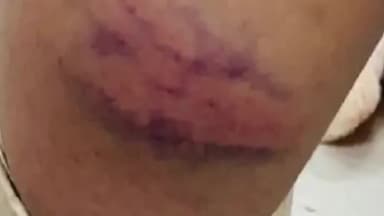 करनाल: जरनेली कॉलोनी स्थित प्राइवेट स्कूल के बाहर एक छात्र पर अन्य छात्रों ने किया जानलेवा हमला, पुलिस से की गई शिकायत