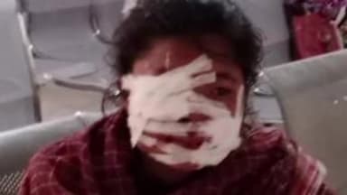 गुमला: टुकु टोली में पागल कुत्ते के हमले से गंभीर रूप से घायल हुई दो सगी बहनें, सदर अस्पताल में चल रहा है इलाज