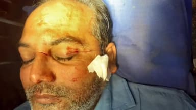 बरेली: नॉवेल्टी चौराहे पर मांझे की चपेट में आने से एक व्यक्ति गंभीर रूप से हुआ घायल, निजी अस्पताल में कराया गया भर्ती