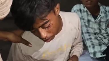 एत्मादपुर: कस्बा खंदौली में पटाखा फटने से युवक हुआ गंभीर रूप से घायल,युवक की हालत गंभीर।