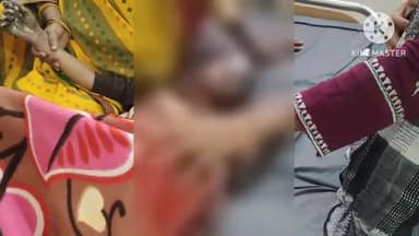 फिरोज़ाबाद: थाना लाइनपार क्षेत्र के रामनगर छारबाग में पटाखा फटने से गंभीर रूप से झुलसा बालक