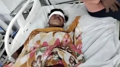 मुरादाबाद: कुर्क बावली में बाइक जेसीबी से टकराई, 2 बाइक सवार गिरकर गंभीर रूप से हुए घायल