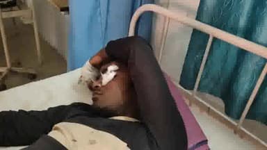 मथुरा: एटीवी कॉलोनी में सिलबट्टा पर गंधक पोटाश पिस्ते वक्त हुआ धमाका एक युवक झुलसा अस्पताल में कराया भर्ती