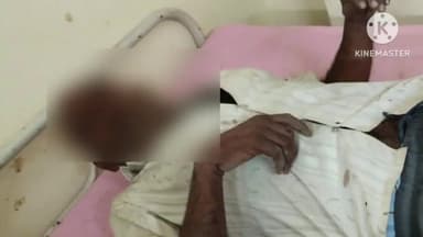 बाह: गांव खेरडंडा में गाली गलौज का विरोध करने पर दो पक्षों में हुआ विवाद,3 लोग घायल,पुलिस जांच में जुटी