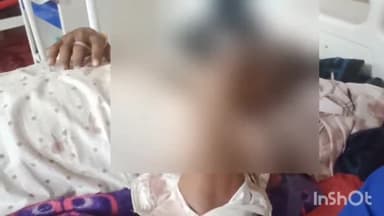 कैसरगंज: पुरेनी के पास बाइक सवार हादसे का हुआ शिकार हालत गंभीर डॉक्टर ने किया रेफर