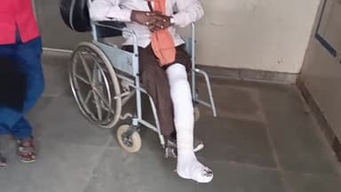 पडरौना: कुबेरस्थान बाजार में अचानक मुड़ने से दो बाइकों में हुई भिड़ंत एक बाइक सवार का टूटा पैर जिला अस्पताल में इलाज जारी