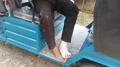 पडरौना: रायपुर चौराहे पर कार की टक्कर से बाइक सवार का टूटा हाथ व पैर, घायल ने कार्रवाई के लिए एसपी को दिया प्रार्थना पत्र