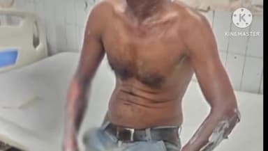 हुज़ूर: शाहपुरा स्थित एक घर में गैस सिलेंडर लीकेज होने से लगी आग, एक महिला सहित पांच लोग झुलसे, दो की हालत गंभीर