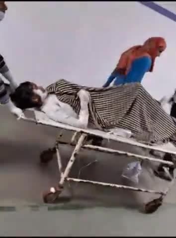 तिर्वा: केहरीपुरवा गांव में पति से विवाद के बाद महिला ने खुद को लगाई आग ,हालत गंभीर कानपुर रेफर