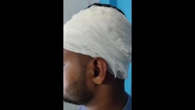 बरौली: पीपरहिया गांव में आपसी विवाद को लेकर युवक पर लाठी डंडे से हमला, इलाज के लिए सदर अस्पताल में भर्ती।