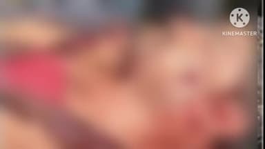 नैनवां: जयपुर में गोगामेड़ी की हत्या के बाद स्कूटी सवार को गोली मारने का मामला; देई निवासी शख्स के रूप में हुई पहचान, उपचार जारी