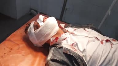 रामपुर: पटवाई क्षेत्र के सेबिया के पास दो मोटरसाइकिलों की टक्कर में तीन लोग घायल जिला अस्पताल में भर्ती उपचार जारी