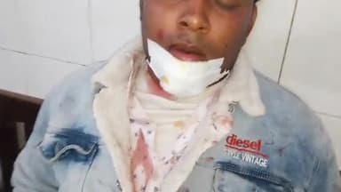 रामपुर: थाना टांडा क्षेत्र के हजरत नगर के पास दो बाइकों की बारात में पति-पत्नी घायल जिला अस्पताल में भर्ती उपचार जारी