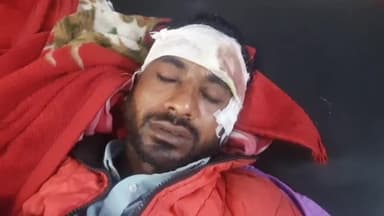 रामपुर: ग्राम मोतीपुरा में आवारा पशु की टक्कर से मोटरसाइकिल सवार हुआ घायल जिला अस्पताल में भर्ती