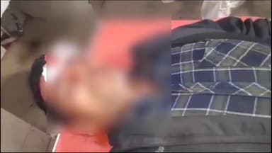 अररिया: बस स्टैंड के  समीप कपड़ा बेच रहे एक युवक को मनचले युवक ने ईट से वार कर किया घायल, सदर अस्पताल में भर्ती