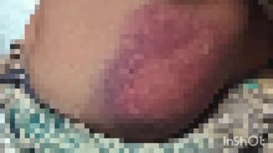 घुवारा: बछरावनी में दो लोगों के द्वारा महिला के साथ की गई मारपीट, महिला ने पुलिस चौकी में की शिकायत