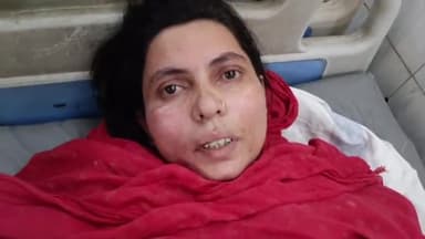 गोपालगंज: मिरलीपुर गांव में आरोपित की तलाश में पहुंची पुलिस ने महिला के साथ की मारपीट, घायल महिला सदर अस्पताल में भर्ती