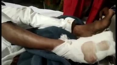 पन्ना: ग्राम हरदी में अचानक सामने भैंस आने की वजह से तेज रफ्तार बाइक हुई अनियंत्रित, हादसे में 3 युवक हुए घायल