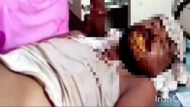 कुरवाई: मेहलुआ चौराहे के समीप कार को बचाने के चक्कर में अनियंत्रित होकर गिरी मोटरसाइकिल,ग्रामीण हुआ घायल