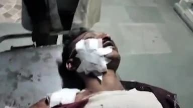 मुरादाबाद: कमालपुर में तेज रफ़्तार 4 व्हीलर ने मारी बाइक में टक्कर पति पत्नी हुआ सड़क दुर्घटना का शिकार