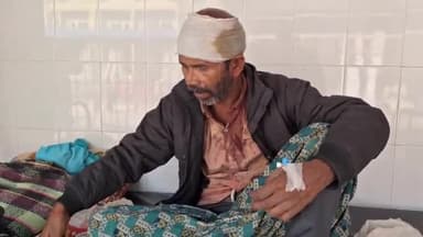 पूर्णिया पूर्व: माधोपारा बंगाली टोला में चोर ने किया मारपीट एक व्यक्ति घायल GMCH में भर्ती