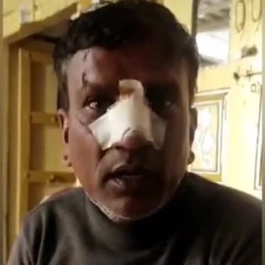 डूंगरपुर: भासोर बस स्टैंड के पास चाइनीज मांझे से कटी बाइक सवार की नाक, हेलमेट पहना फिर भी हो गया हादसा।