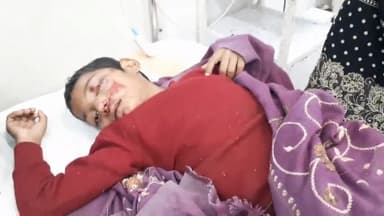 सासाराम: नौहट्टा बाजार में या नियंत्रित बाइक ने एक 7 वर्षीय लड़का को मारी टक्कर, लड़का हुआ घायल