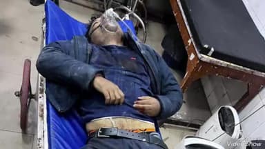 सुल्तानपुर: कोतवाली देहात में हुई मुठभेड़ में एक लाख इनामिया अभियुक्त को लगी गोली,घायल को जिला अस्पताल के डॉक्टरों ने किया मृत घोषित